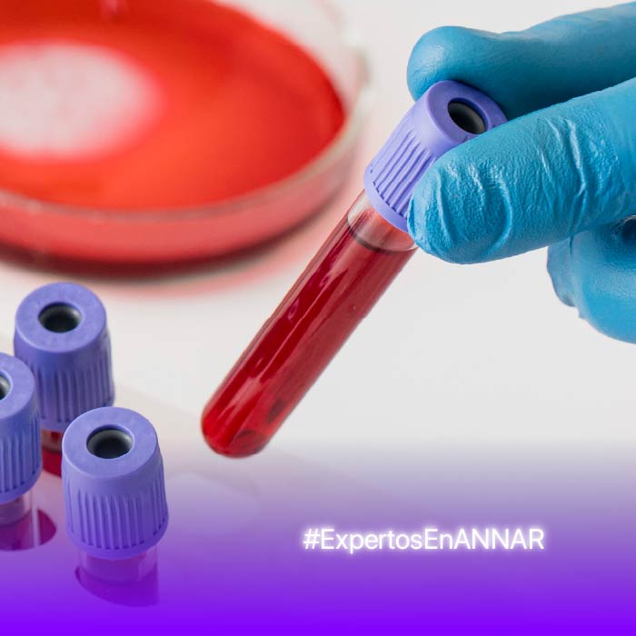 ANNAR-ARTICULO-WEB-Evaluación-de-los-nuevos-analizadores-hema-MINIATURA