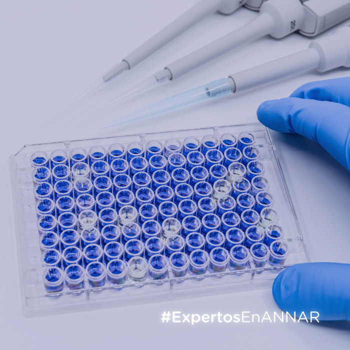 ANNAR-Articulo-Diagnostica-Miniatura-ANAS en enfermedades del tejido conectivo