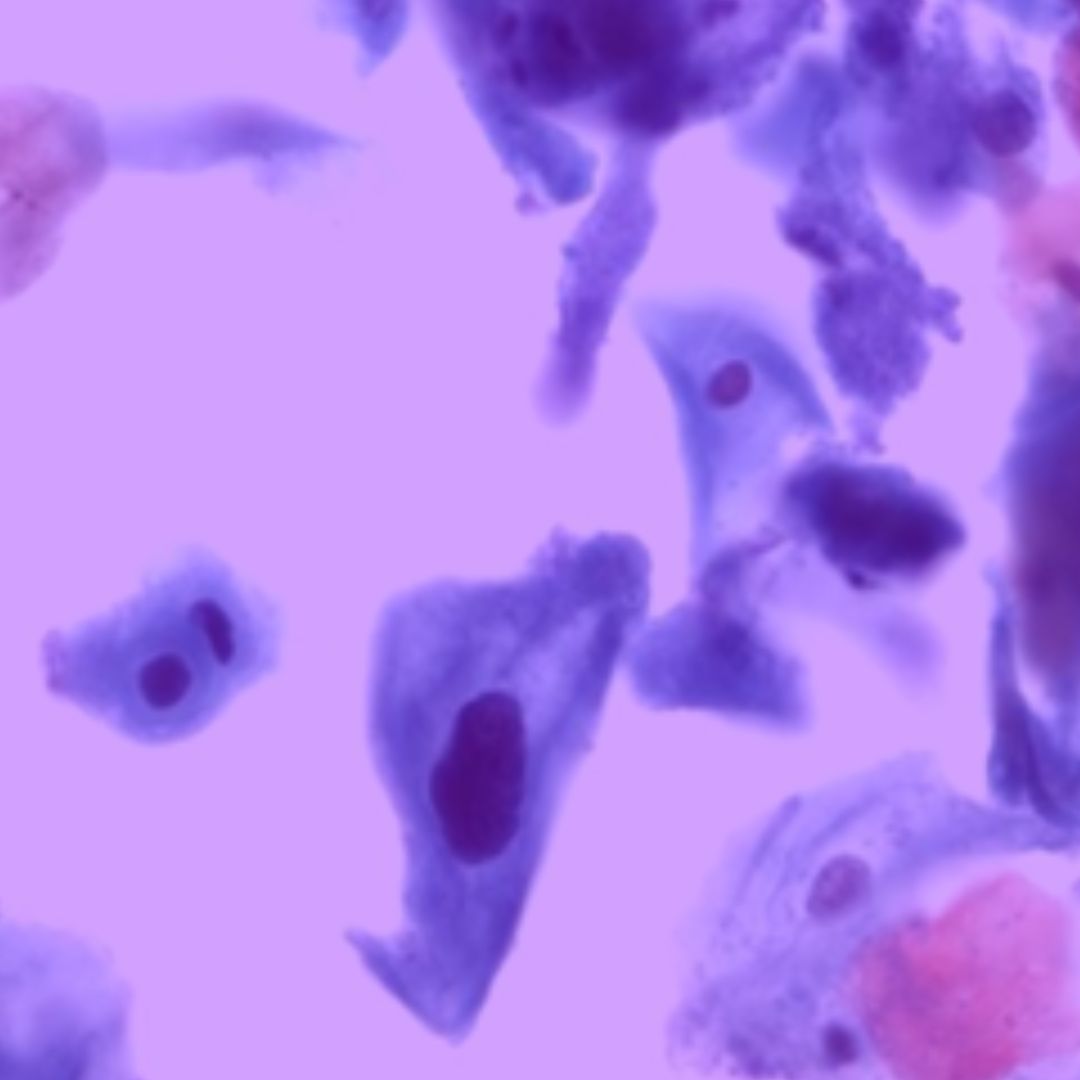 LA VERDAD DE LA CITOLOGÍA ANORRECTAL EN HOMBRES - ANNAR Health ...