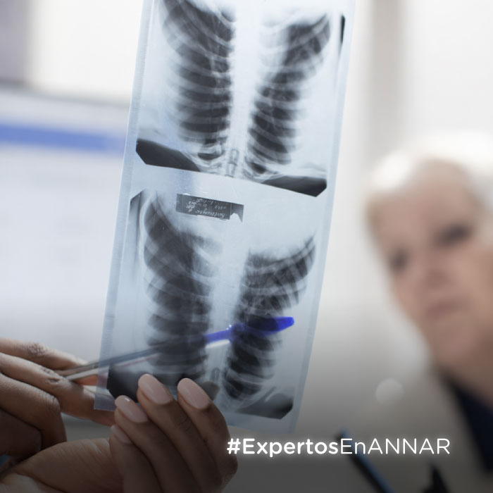 Annar-DX-Diagnóstico-de-la-tuberculosis-en-la-era-molecular-articulo-web-minuatura