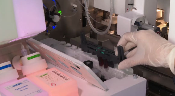 Capillarys-3-DBS-DX-ANNAR-IMAGEN04