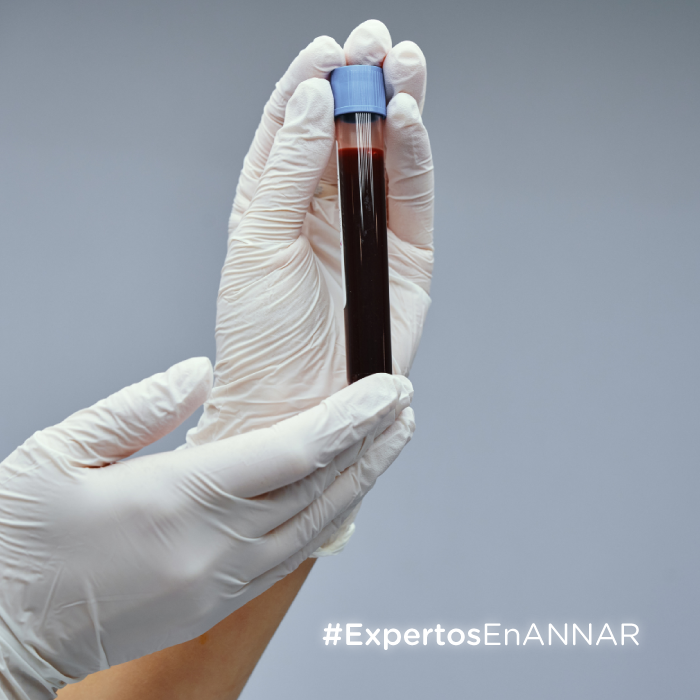 Criptococosis-annar-tamizaje--diagnostica-MINIATURA