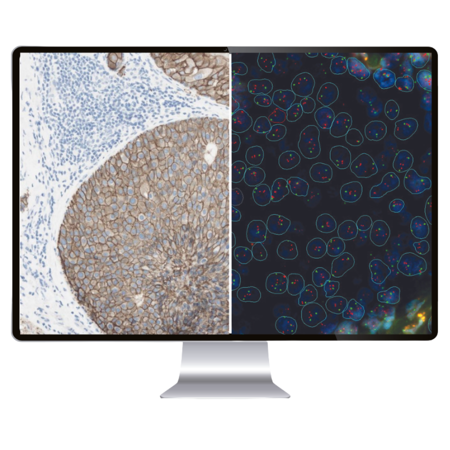 SISTEMA DE DIGITALIZACIÓN -DX PATOLOGÍA-ANNAR-2