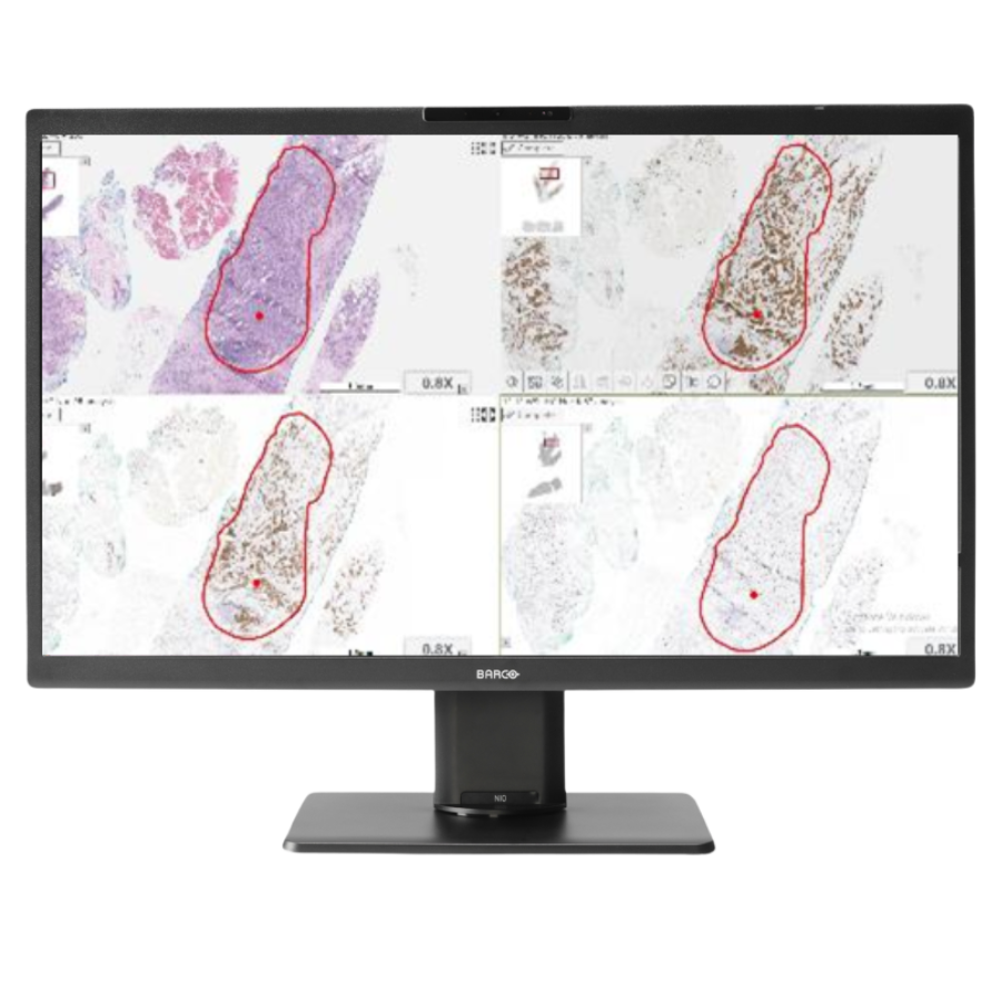 SISTEMA DE DIGITALIZACIÓN -DX PATOLOGÍA-ANNAR-3