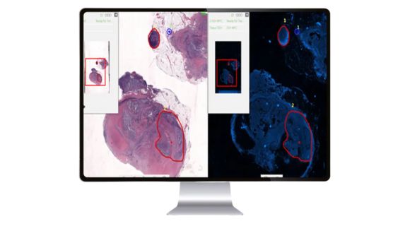 SISTEMA DE DIGITALIZACIÓN -DX PATOLOGÍA-ANNAR-5