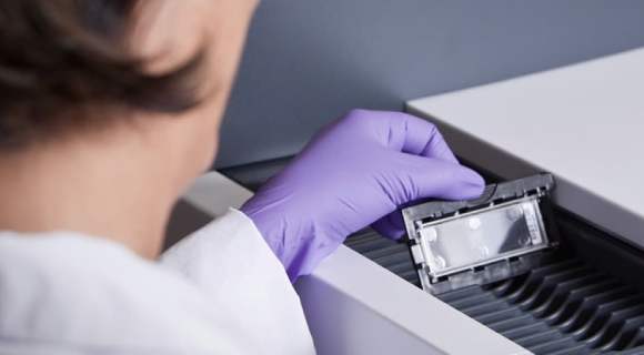 SURESCAN MICROARRAY SCANNER-DX-ANNAR-IMAGEN05