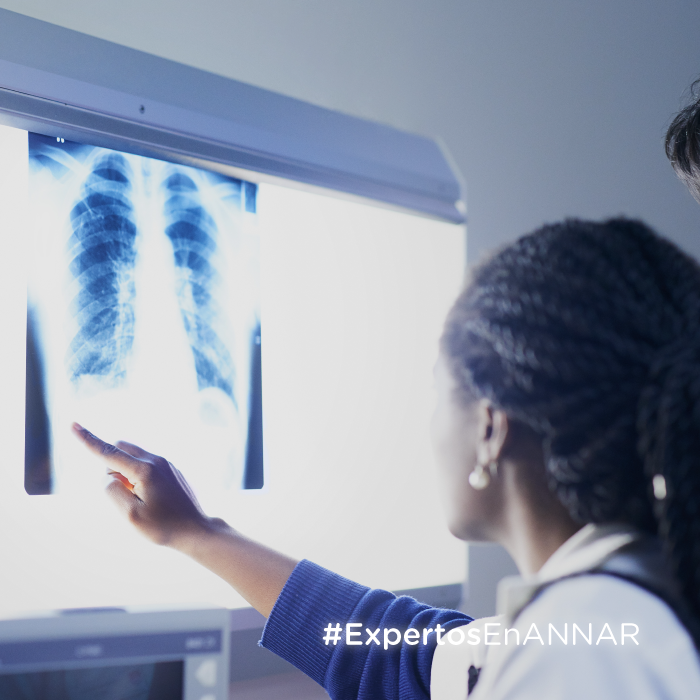 Tuberculosis-Desafío-Global-ANNAR-WEB-MIN