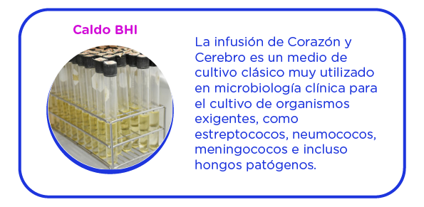 Los medios de cultivo líquidos se utilizan preferiblemente para favorecer el desarrollo bacteriano de células estresadas. 
En determinadas ocasiones no se pueden sustituir por los medios sólidos, 
por ejemplo, en la síntesis de exotoxinas, pigmentos, enzimas, etc.
