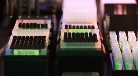 nimbus-IVD-DX-ANNAR-IMAGEN04