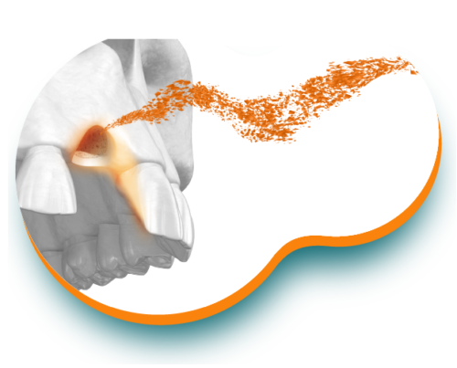 odontologia-regeneración-natural-de-tejido-annar-03