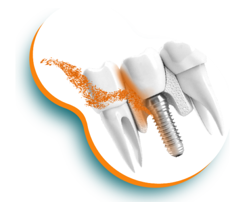 odontologia-regeneración-natural-de-tejido-annar-04