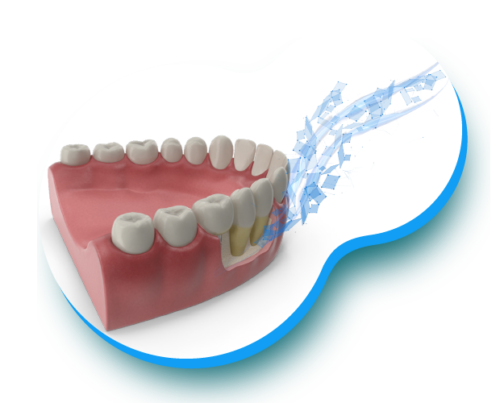 odontologia-regeneración-natural-de-tejido-annar-06