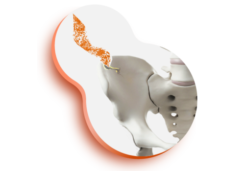 regeneracion_estructura_osea_quirubone_annar_Bh-04